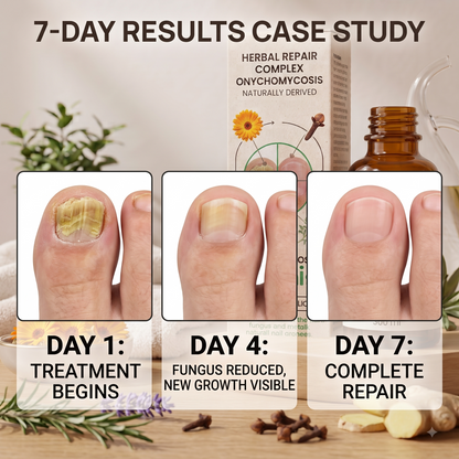 Onychomycosis Repair Bacteriostatic Liquid designed to treat fungal nail infections